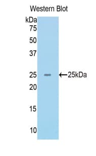 RAD50 Antibody (aa400-595, Biotin)