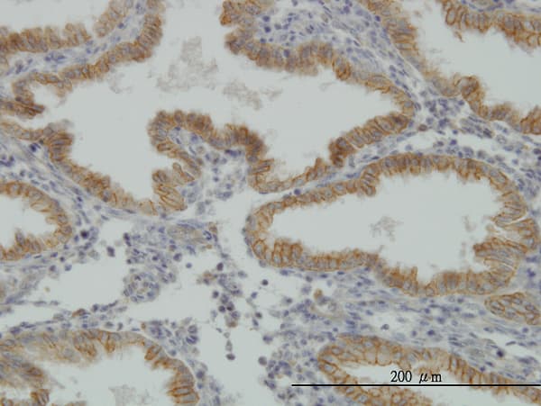 MUSK Antibody (clone 2H6)