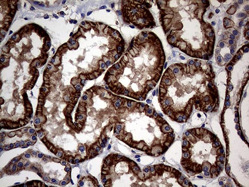 Monoclonal Mouse anti-Human ABCB1 / MDR1 / P Glycoprotein Antibody (clone OTI16D9, aa995-1280, IHC, WB)