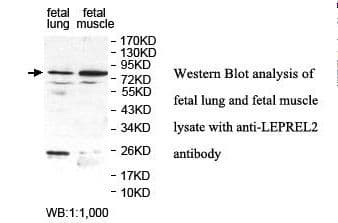 P3H3 / LEPREL2 Antibody (aa400-579)
