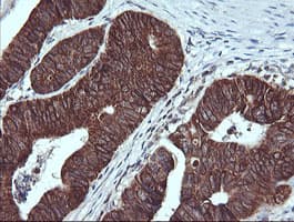 ACAA2 Antibody (clone OTI3C6)