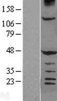 HERPUD1 / HERP Protein (Over-Expression Lysate Myc-DDK (Flag))
