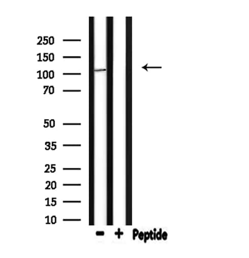 Polyclonal Rabbit anti-Human GTF3C3 Antibody (IF, WB)