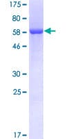 Human EIF2B2 Protein (Recombinant GST)