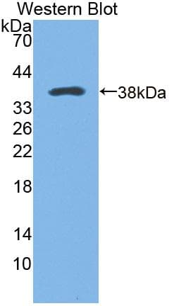 CAMK2B / CaMKII Beta Antibody (aa1-301)