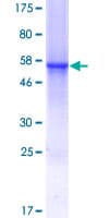 Human C1QTNF7 / CTRP7 Protein (Recombinant GST)