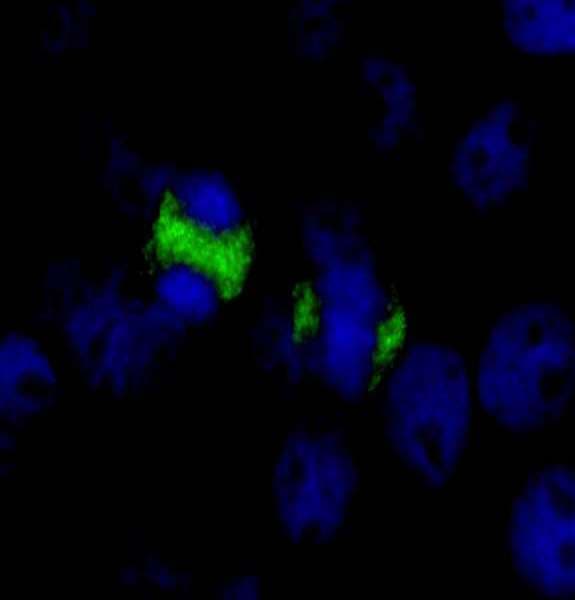 Polyclonal Rabbit anti-Human CENPF / CENP-F Antibody (aa1800-1850, IF)