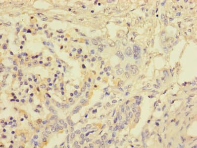 FOSL2 / FRA-2 Antibody