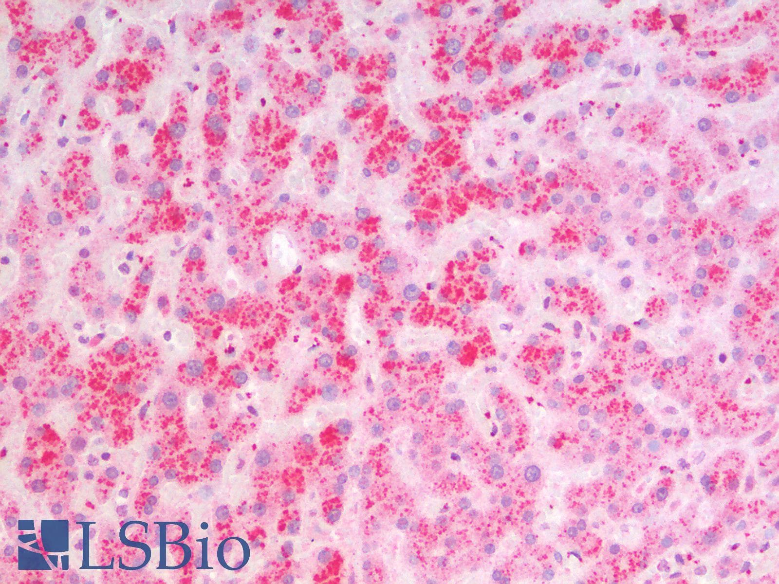 IHC-plus™ Polyclonal Goat anti-Human MSI2 Antibody (N Terminus, IHC, WB)