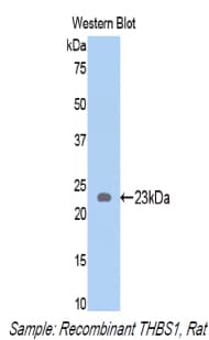 THBS1 / Thrombospondin-1 Antibody (aa71-259)