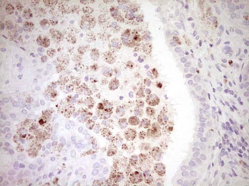 Monoclonal Mouse anti-Human CTGF Antibody (clone OTI2C9, aa27-349, IHC)