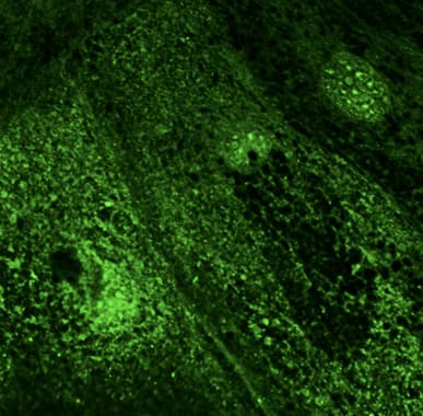 RAB28 Antibody (C-Terminus)