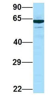 PRKCSH Antibody (aa155-204)