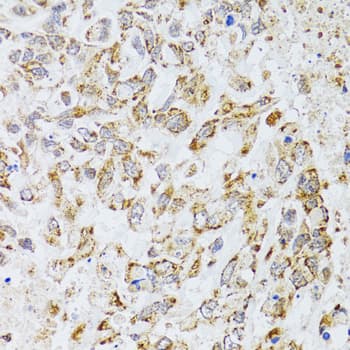 AIFM3 Antibody