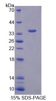 Rat Neurochondrin Protein (Recombinant His-T7)