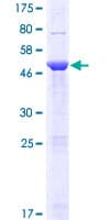 Human HCA557B / METTL21A Protein (Recombinant GST)