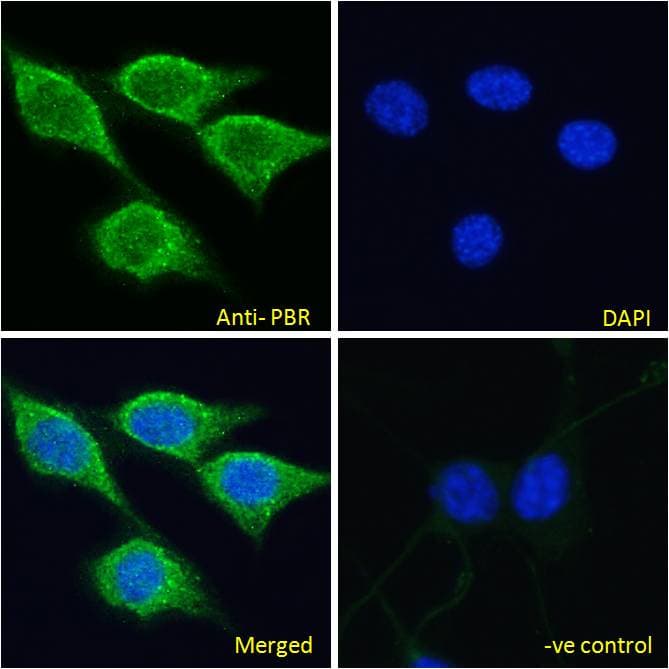 IHC-plus™ Polyclonal Goat anti-Mouse TSPO / PBR Antibody (aa156-169, IHC, IF, WB)