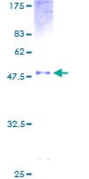 Human AICDA / AID Protein (Recombinant GST)