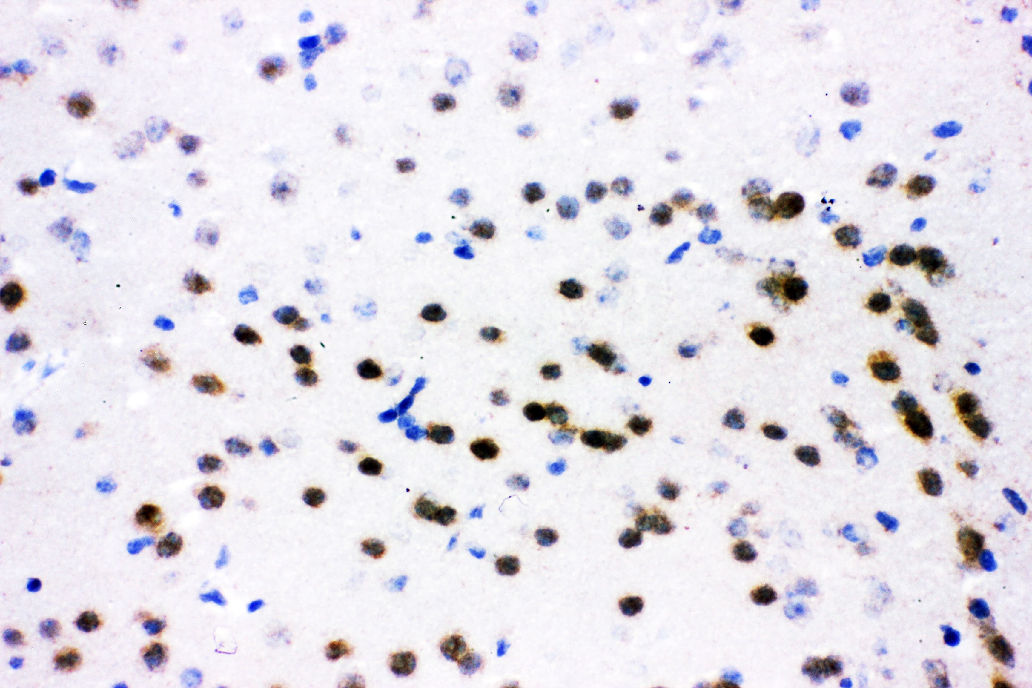 ATF2 Antibody (aa93-450)