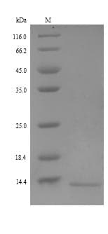Human RETNLB / RELM-Beta Protein (Recombinant 6His, N-terminus)