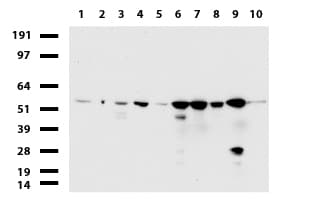 Monoclonal Mouse anti-Human TP / Thymidine Phosphorylase Antibody (clone UMAB90, Carrier-free, aa311-482, IHC, WB)