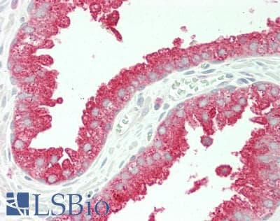 IHC-plus™ Polyclonal Rabbit anti-Human MLST8 / GBL Antibody (IHC, WB)