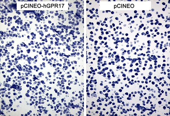 Monoclonal Mouse anti-Human GPR17 Antibody (clone OTI6B9, N-Terminus, IHC)