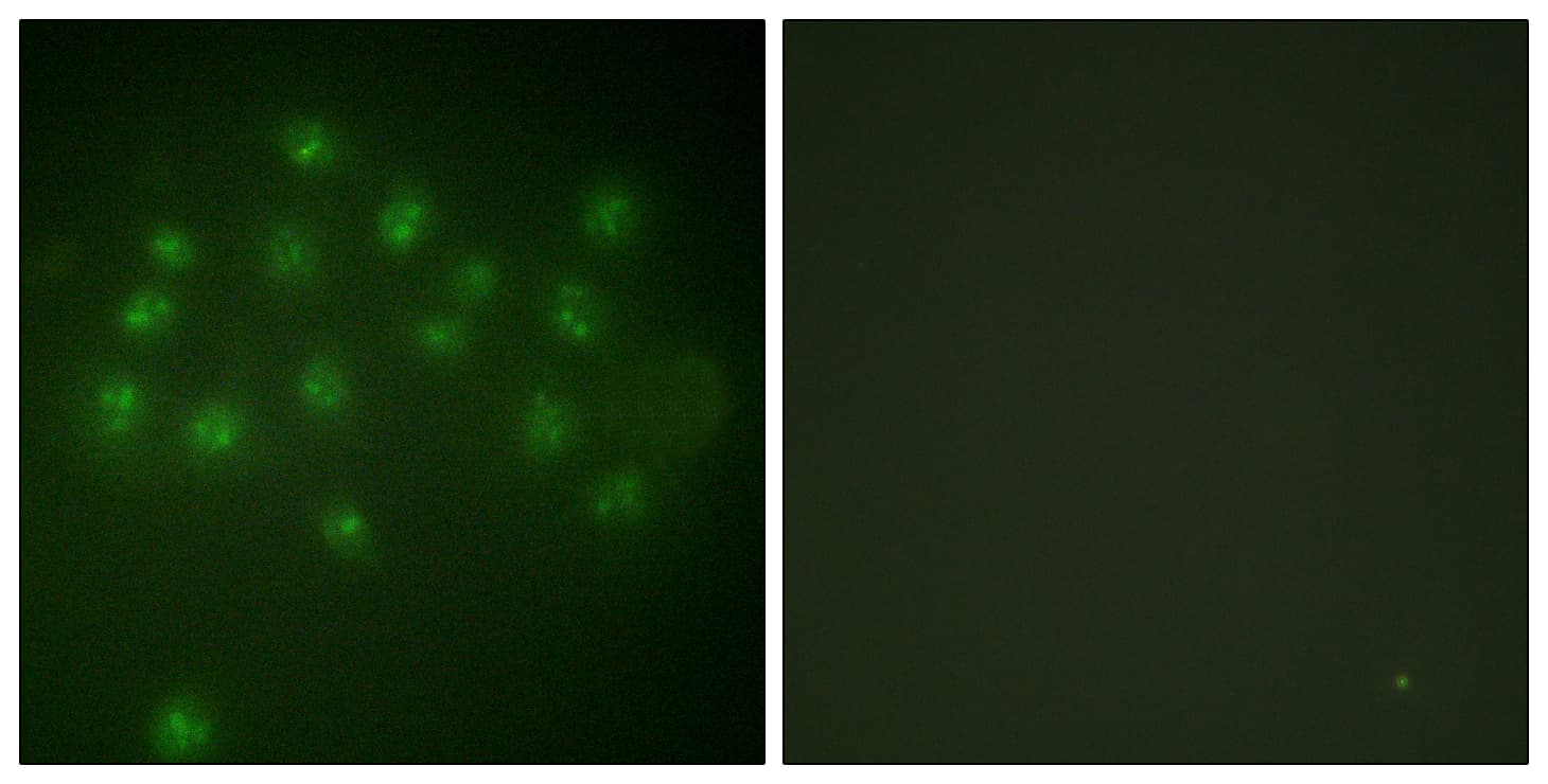 Polyclonal Rabbit anti-Human Vitamin D Receptor / VDR Antibody (phospho-Ser208, IF, WB)
