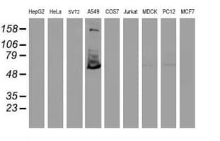 TULP3 Antibody (clone OTI4E5)