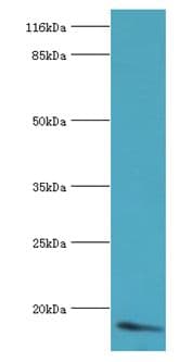 NPPB / BNP Antibody (aa27-102)