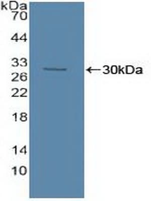SMPD1 / Acid Sphingomyelinase Antibody (aa319-579)