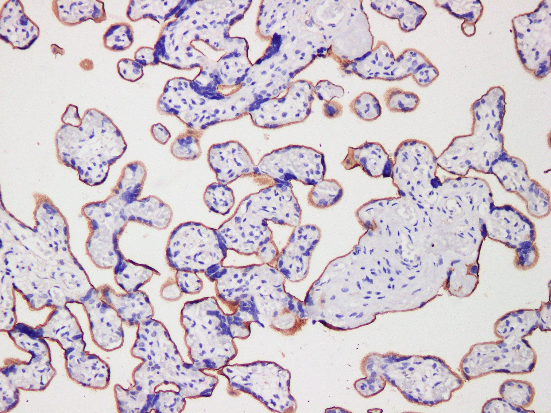 CD105 Antibody