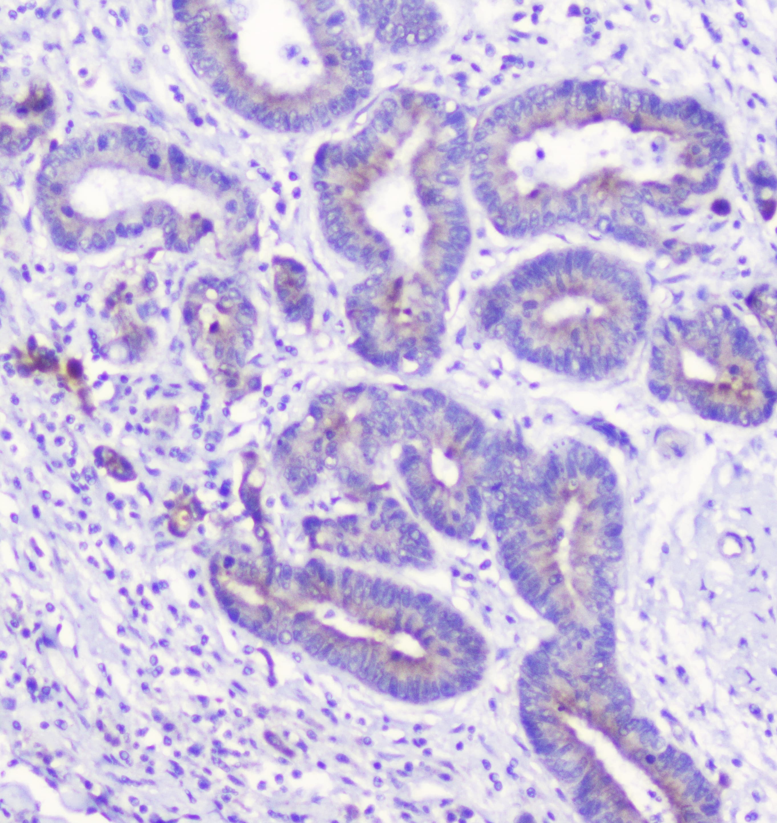 LATS1 Antibody