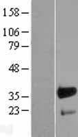 FHL3 Protein (Over-Expression Lysate Myc-DDK (Flag))