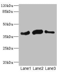 Polyclonal Rabbit anti-Human BCAP / PHF11 Antibody (IHC, WB)