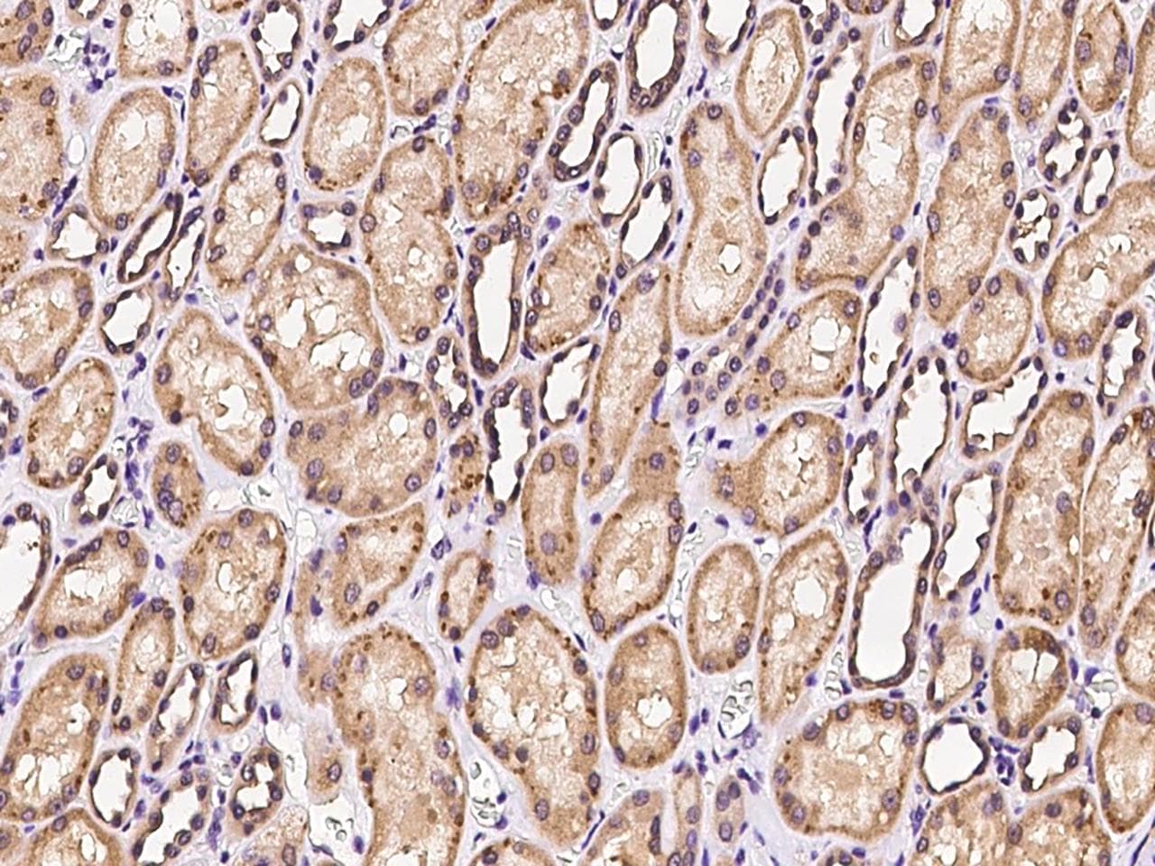PPP2R1B Antibody