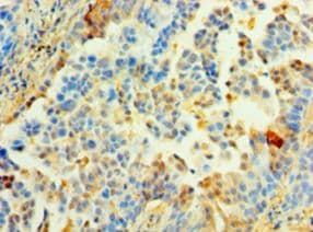 BM022 / MRPL1 Antibody (aa51-324)