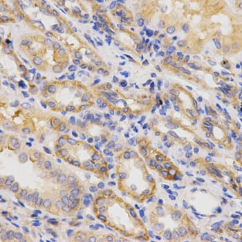 Polyclonal Rabbit anti-Human ITGB5 / Integrin Beta 5 Antibody (IHC, WB)