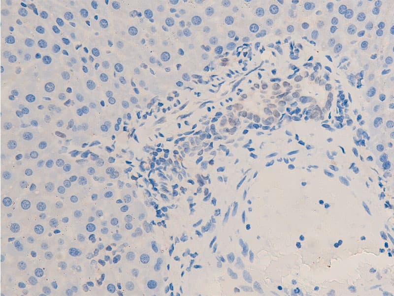 CHEK2 / CHK2 Antibody (phospho-Thr68)
