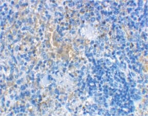 Polyclonal Rabbit anti-Human LY96 / MD2 / MD-2 Antibody (IHC, IF, WB)