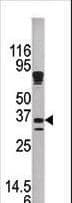 KLK9 / Kallikrein 9 Antibody (aa1-30)