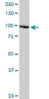 Monoclonal Mouse anti-Human DDX11 / CHLR1 Antibody (clone 3C1, IHC, WB)