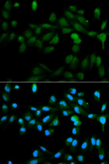 P450SCC / CYP11A1 Antibody