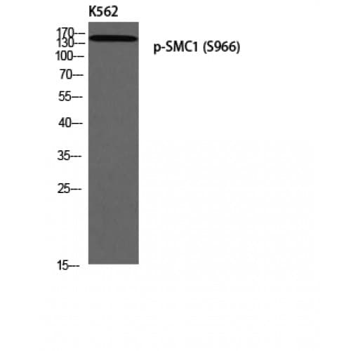 Polyclonal Rabbit anti-Human SMC1A / SMC1 Antibody (910-990 aa, IHC, WB)