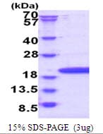 Human POP7 Protein (Recombinant His)