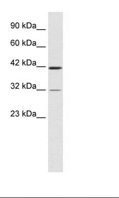 Polyclonal Rabbit anti-Human CHST4 / GlcNAc6ST2 Antibody (aa234-283, IHC, WB)