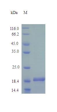 Human IHH Protein (Recombinant)