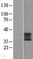 ABO Glycosyltransferase Protein (Over-Expression Lysate Myc-DDK (Flag))