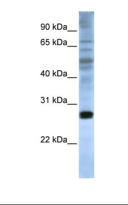 Polyclonal Rabbit anti-Human EIF4E Antibody (C-Terminus, IHC, WB)