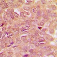 Polyclonal Rabbit anti-Human STAT5 A+B Antibody (C-Terminus, IHC, WB)